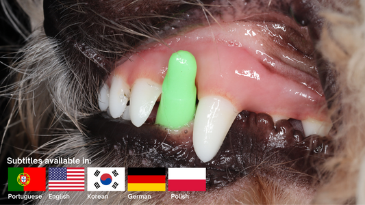 How to correct linguoverted canines with crown extensions