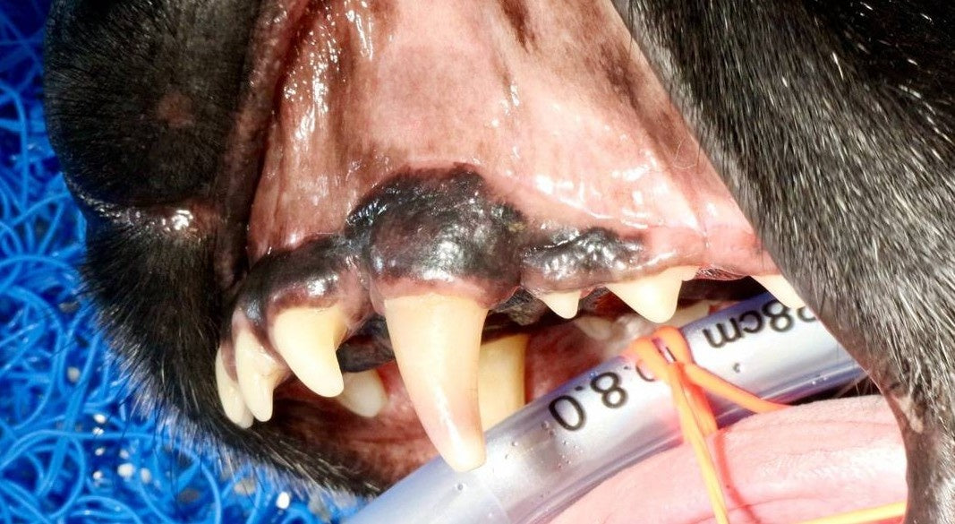 Maxillary Canine Extraction